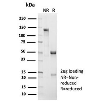 Beta Catenin antibody