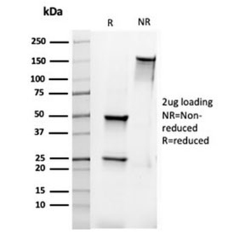 Bcl-2 antibody