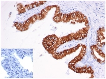 EpCAM antibody