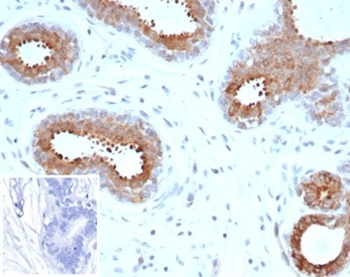 BAP1 antibody