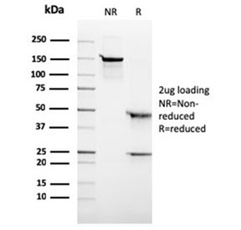 ALK antibody