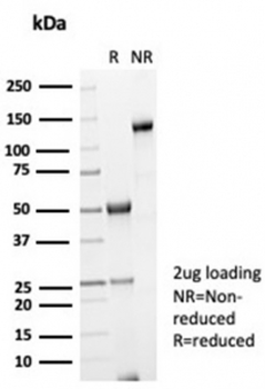 Galectin 3 antibody