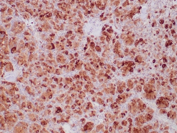 SDHB antibody