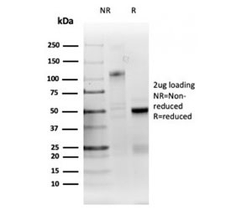 Ribonucleotide Reductase M1 antibody