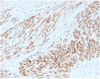 SMMHC antibody