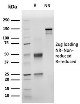 NKX3.1 antibody