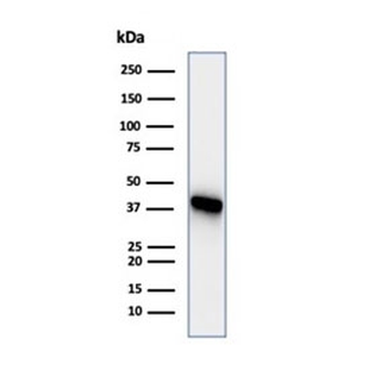 CKB Antibody / Creatine kinase B