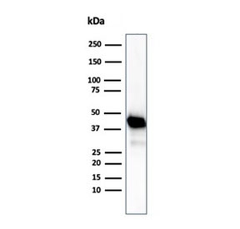 CKB Antibody / Creatine kinase B