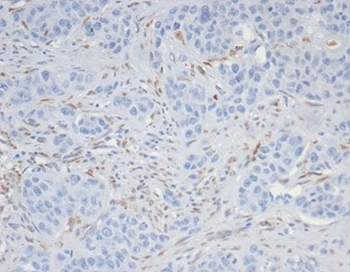 SALL4 Antibody / ZNF797