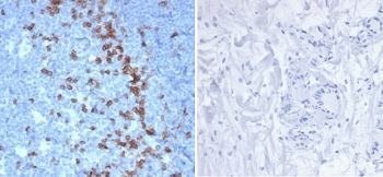 Recombinant PDCD1 Antibody / PD-1 / PD1