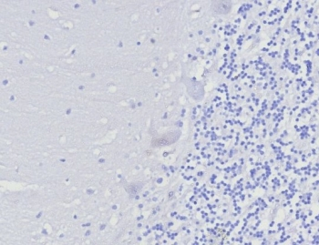 FOXP3 Antibody / Scurfin