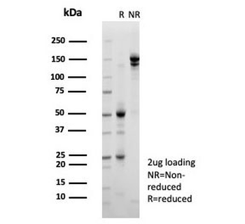 KDM5C Antibody / JARID1C / SMCX