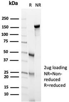CD105 Antibody / Endoglin