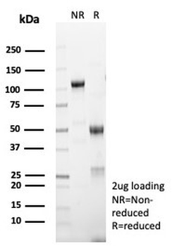 MART-1 / Melan-A Antibody