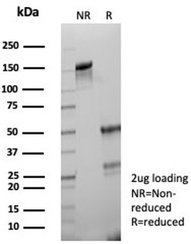 PD-L1 Antibody / B7-H1 / CD274