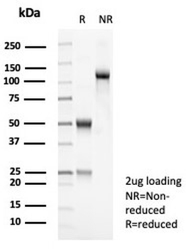 TRP1 / Tyrosinase-Related Protein-1 Antibody