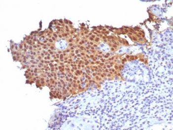 p16INK4a Antibody / CDKN2A