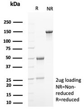 p16INK4a Antibody / CDKN2A