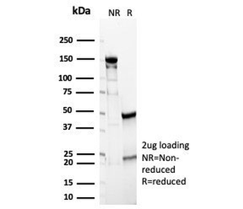 CA9 Antibody / Carbonic Anhydrase IX