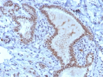 TRPS1 Antibody / Tricho-rhino-phalangeal syndrome type I