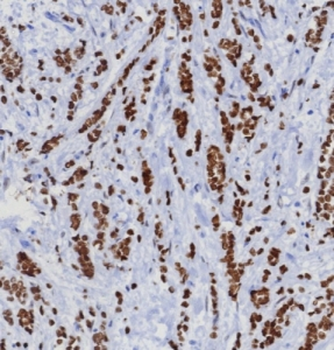 TRPS1 Antibody / Tricho-rhino-phalangeal syndrome type I