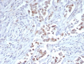 TRPS1 Antibody / Tricho-rhino-phalangeal syndrome type I