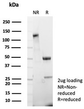 CDH17 Antibody / Cadherin 17