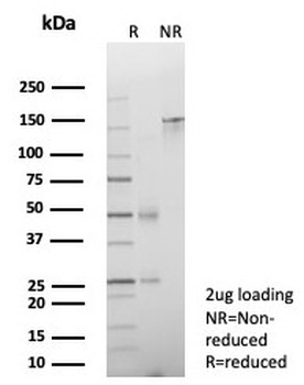 CDH17 Antibody / Cadherin 17