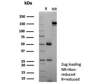 NECAB1 Antibody / N-terminal EF-hand calcium binding protein 1