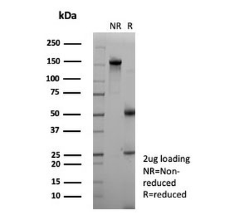 NECAB1 Antibody / N-terminal EF-hand calcium binding protein 1