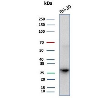 CA3 Antibody / Carbonic Anhydrase III