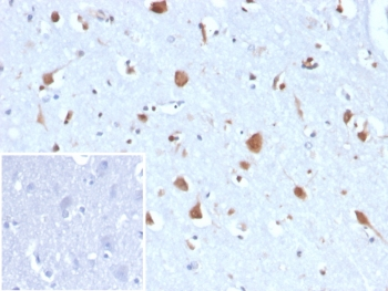 CA8 Antibody / Carbonic Anhydrase VIII