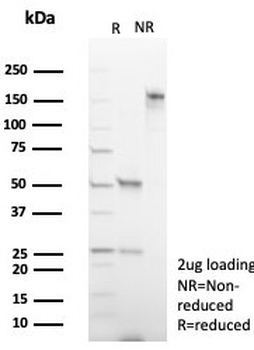 DBC2 Antibody / Deleted in breast cancer gene 2 / RHOBTB2