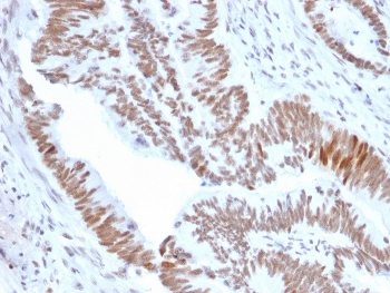 DBC1 Antibody / Deleted in breast cancer 1 / CCAR2