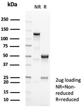 Carboxypeptidase A1 Antibody / CPA1