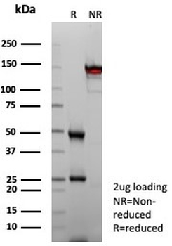 Carboxypeptidase A1 Antibody / CPA1