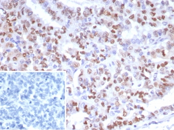 PMS2 Antibody / Post Meiotic Segregation Increased 2
