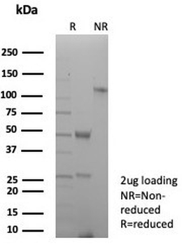 Pan-HLA Antibody MHC II (DP/DQ/DR)