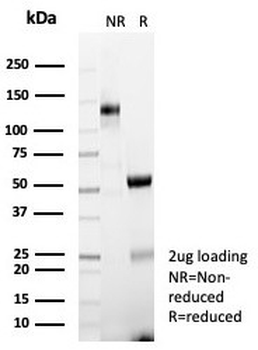 HLA-ABC Antibody (MHC I)