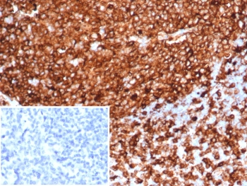 HLA-DR Antibody (MHC II)