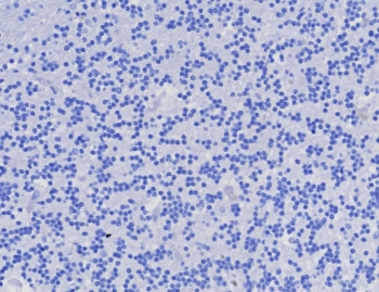 AMACR / p504S Antibody (Prostate Cancer Marker)