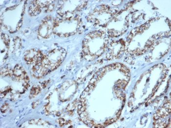 AMACR / p504S Antibody (Prostate Cancer Marker)