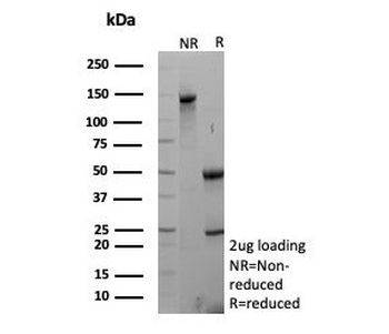 K-Cadherin Antibody / CDH6