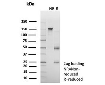 Mineralocorticoid Receptor Antibody / MR / NR3C2