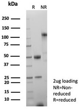 LEF1 Antibody / Lymphoid enhancer-binding factor 1 / TCF1 alpha