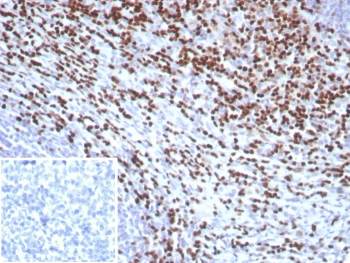 LEF1 Antibody / Lymphoid enhancer-binding factor 1 / TCF1 alpha