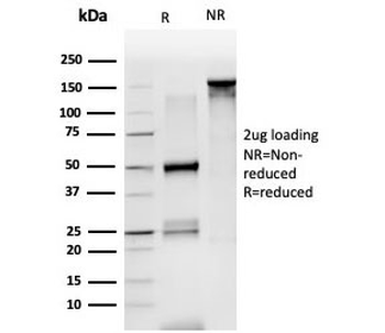 LDB2 Antibody / LIM domain binding 2
