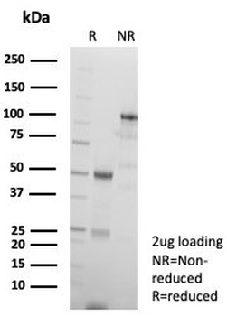 p63 Antibody / Tumor protein 63