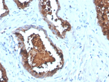 PSAP Antibody / Prostate Specific Acid Phosphatase