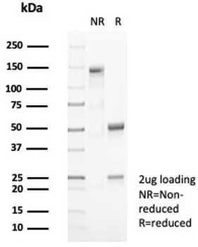 CD10 Antibody / Neprilysin